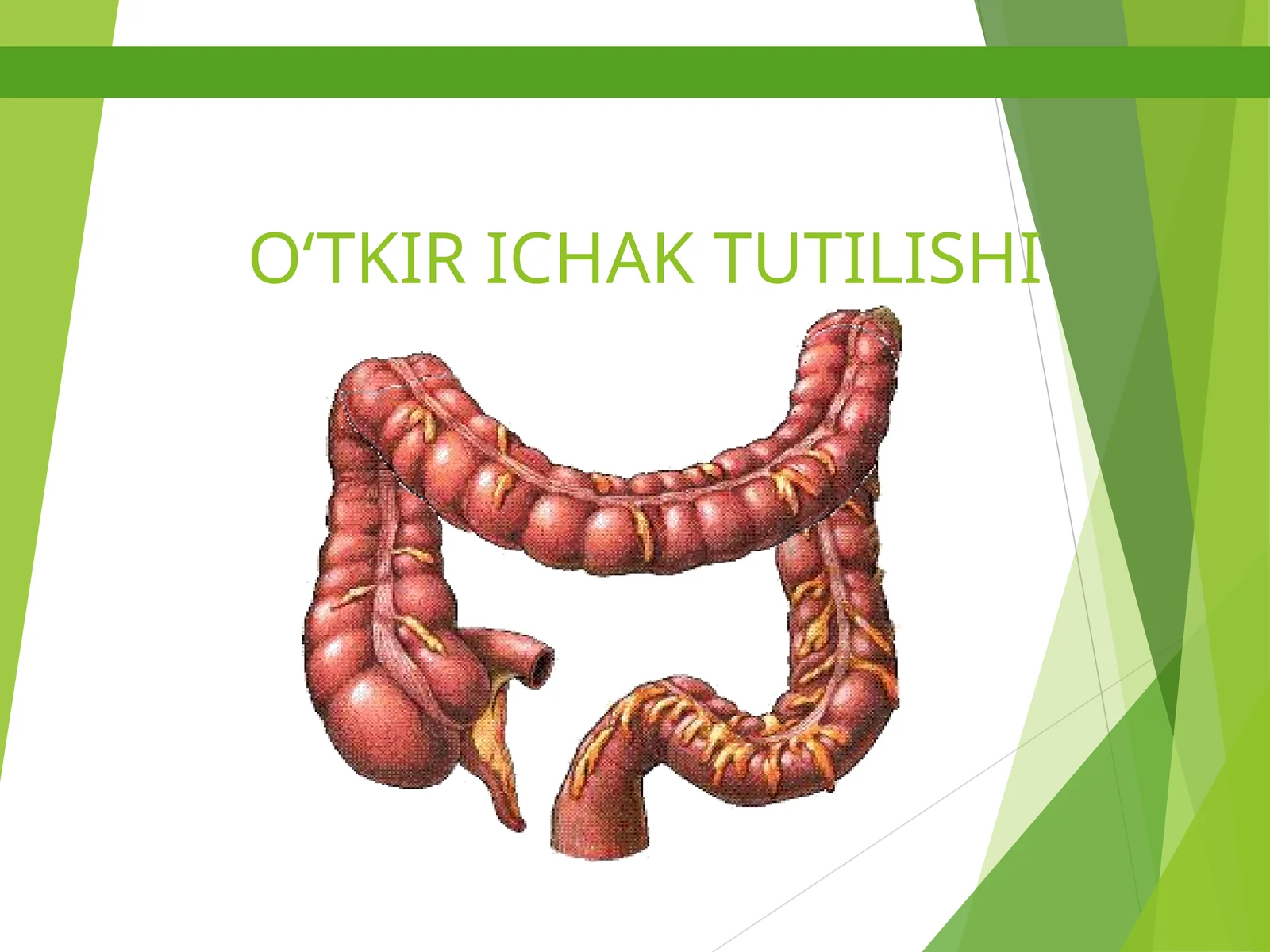 O'tkir ichak tutilishi