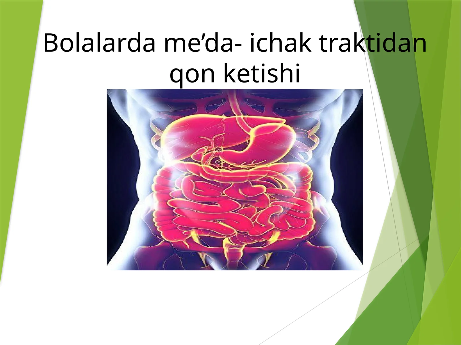 Oshqozon ichakdan qon ketishi